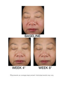 TimeWise Replenishing Serum C+E® 20 TimeWise Replenishing Serum C+E® -GlowUp Cosmetics J2001771 DM ES Replen C PDP 10 26 20 Before After 01