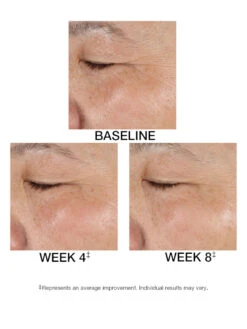 TimeWise Replenishing Serum C+E® 21 TimeWise Replenishing Serum C+E® -GlowUp Cosmetics J2001771 DM ES Replen C PDP 10 26 20 Before After 02