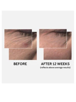 TimeWise Miracle Set 3D® -GlowUp Cosmetics mary kay miracle set 3d above before after