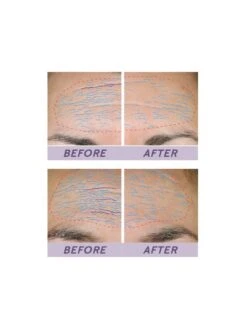 TimeWise Repair® Volu-Firm® Advanced Lifting Serum -GlowUp Cosmetics mary kay twr before after forehead