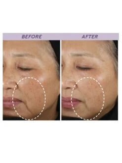 TimeWise Repair® Volu-Firm® Advanced Lifting Serum -GlowUp Cosmetics mary kay twr before after woman